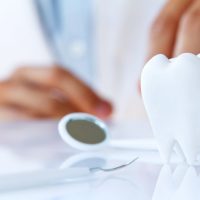 Some FAQS on Dental Insurance Plans and Plan