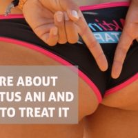 More about Pruritus Ani and how to treat it