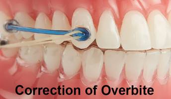 Modern Orthodontic Care in Munich Schwabing: Advanced Solutions for Confident Smiles